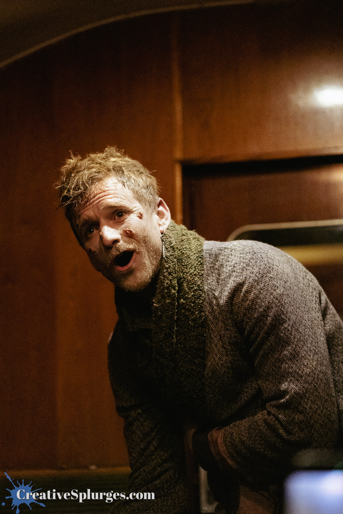 A man with tousled hair and visible facial injuries is standing and looking surprised or distressed, dressed in a knitted scarf and a textured jacket, set against a dark wooden background.